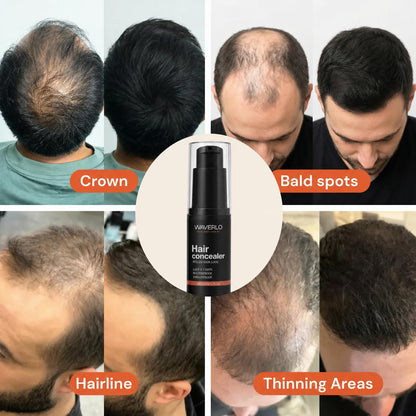 Hair Density Filler