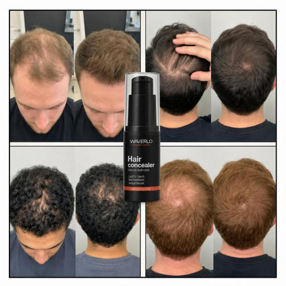Hair Density Filler